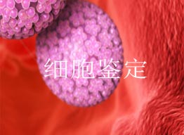 為什么要進(jìn)行細(xì)胞鑒定？